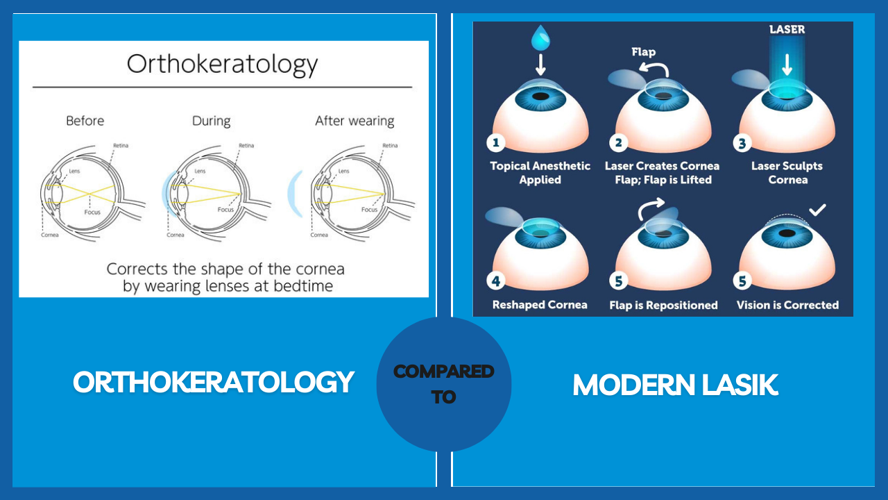 Orthokeratology and LASIK A Comparison Official Site