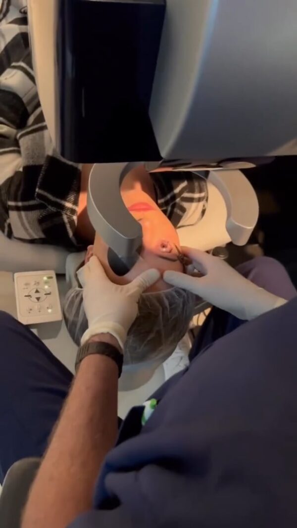 Influencer Gets LASIK in Kansas City and Shares Full Experience