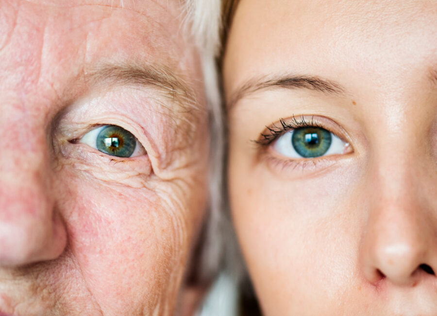 LASIK regression
